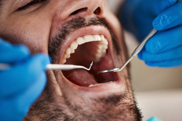 Best Urgent Tooth Repair  in Rocky Mount, NC